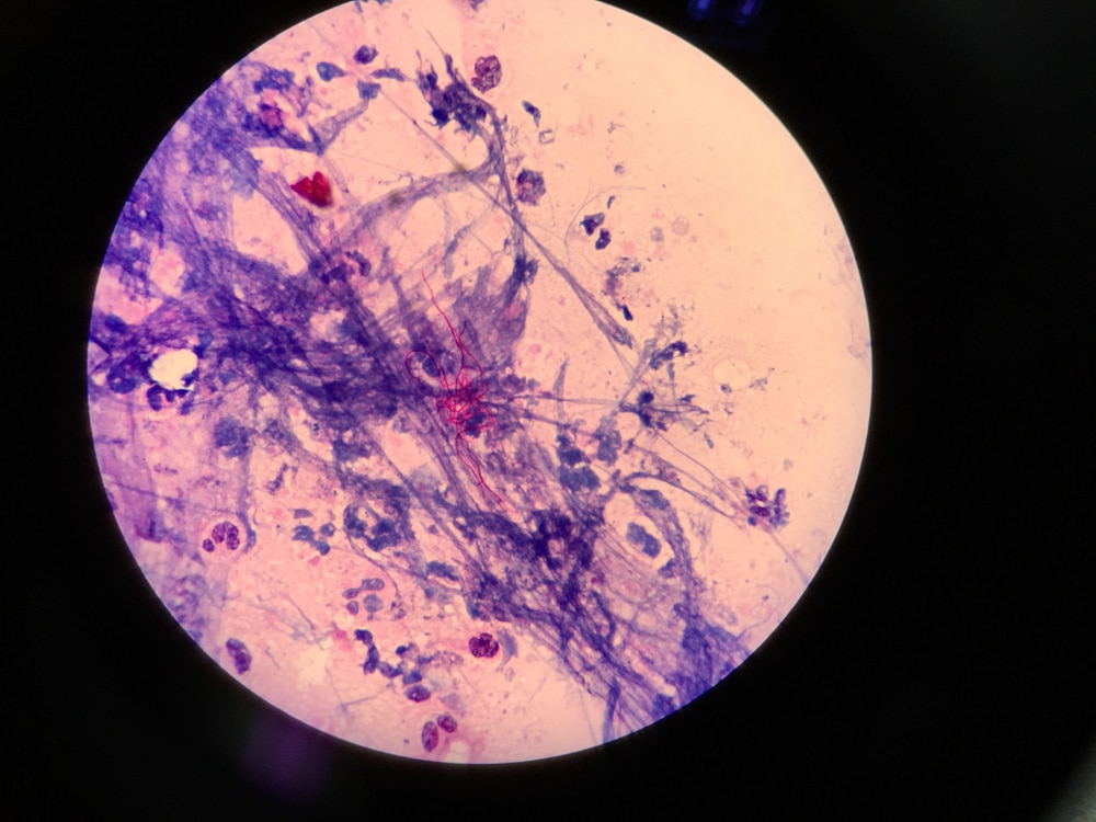  Nocardia Bacteria inside the microscope
