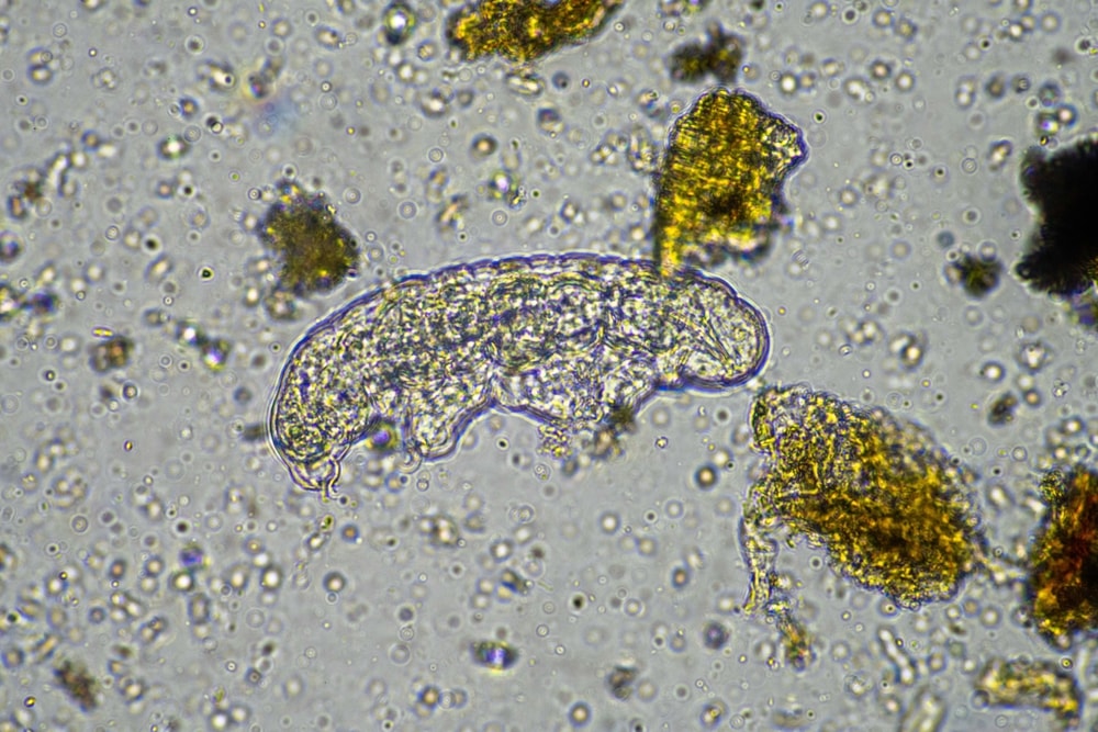 Nematode (Nematoda sps) under the microscope