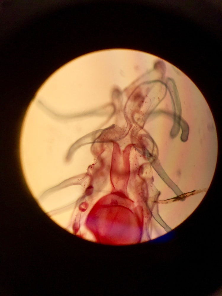 Larvae inside the microscope