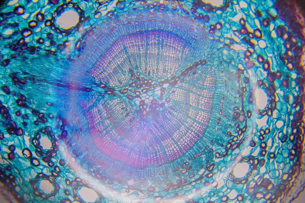 Microscopy of a tree cell